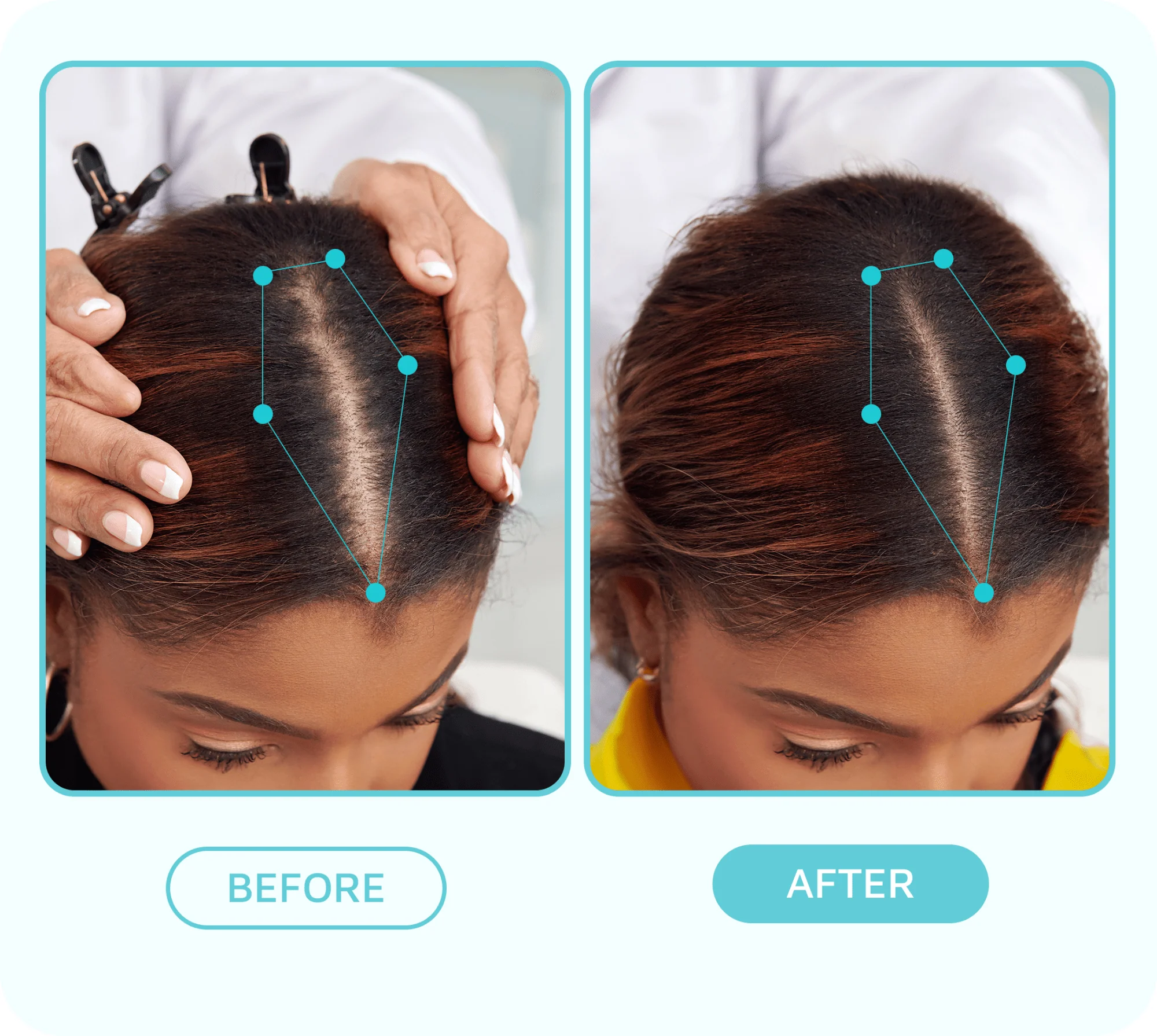 Healthy Hair Fixation Trio | Scalp Fixer Serum - Image 5